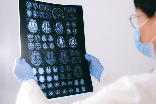 Beyond CB1 and CB2: Why GPR55 Could Reshape Cannabinoid Science
